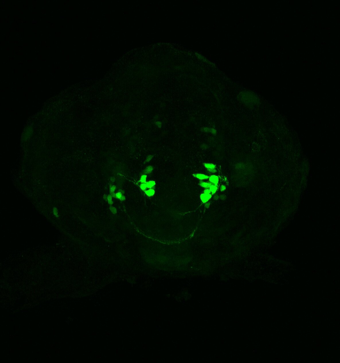 xeom:GFP 36hpf frontal
