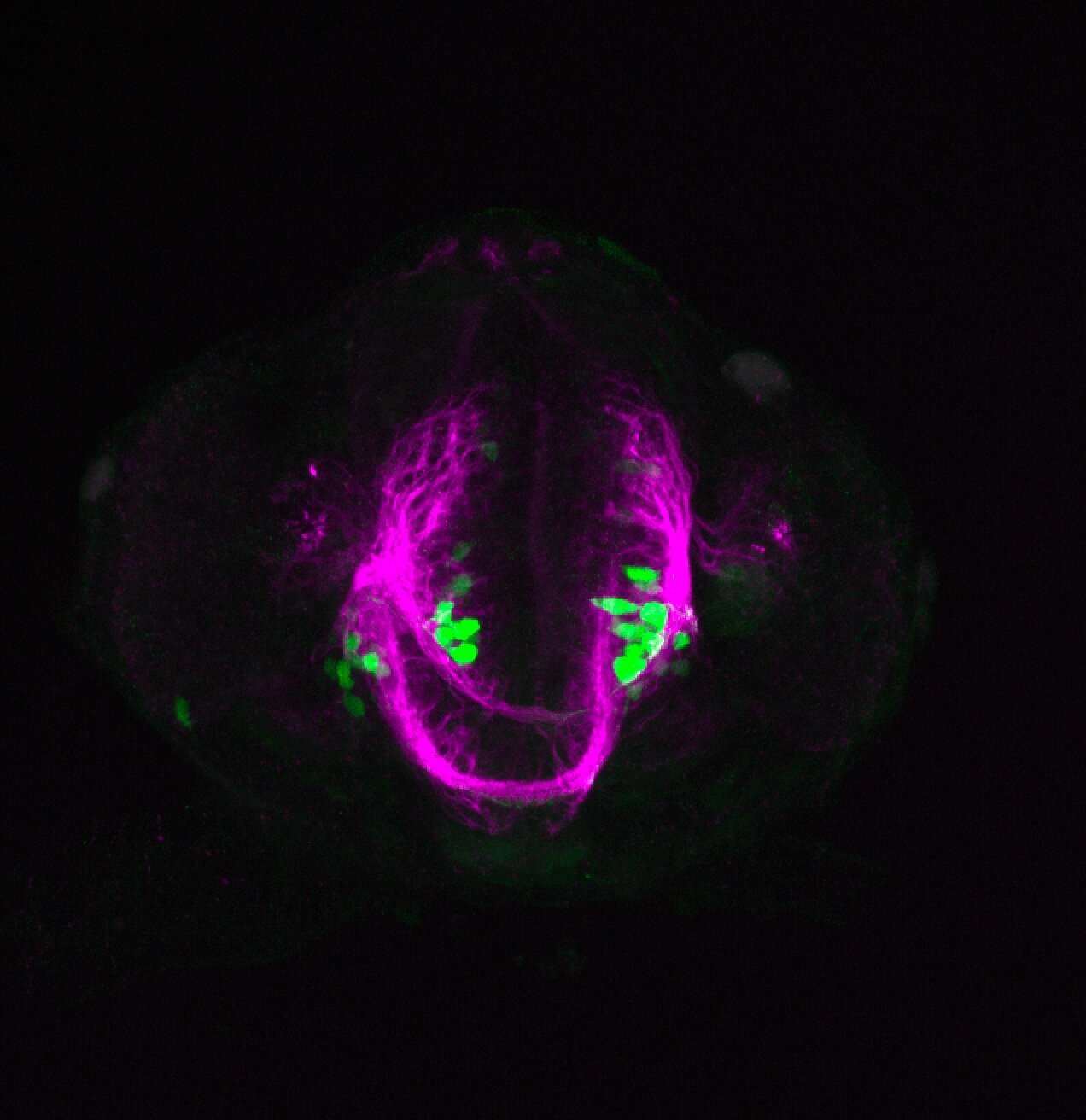 xeom:GFP 36hpf frontal with tubulin(magenta)