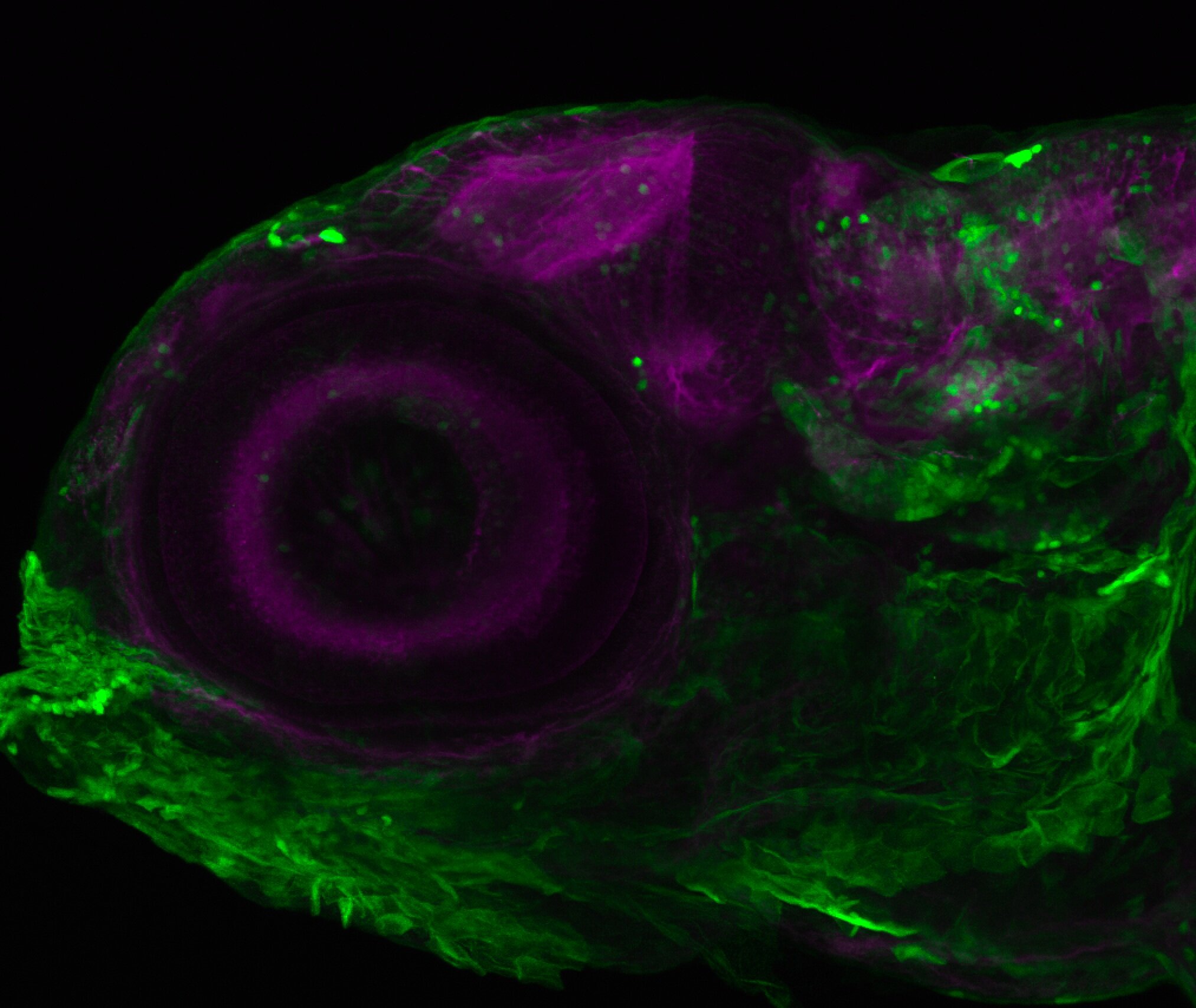 Et(krt4:EGFP)sqet24 5dpf lateral with tubulin (magenta)