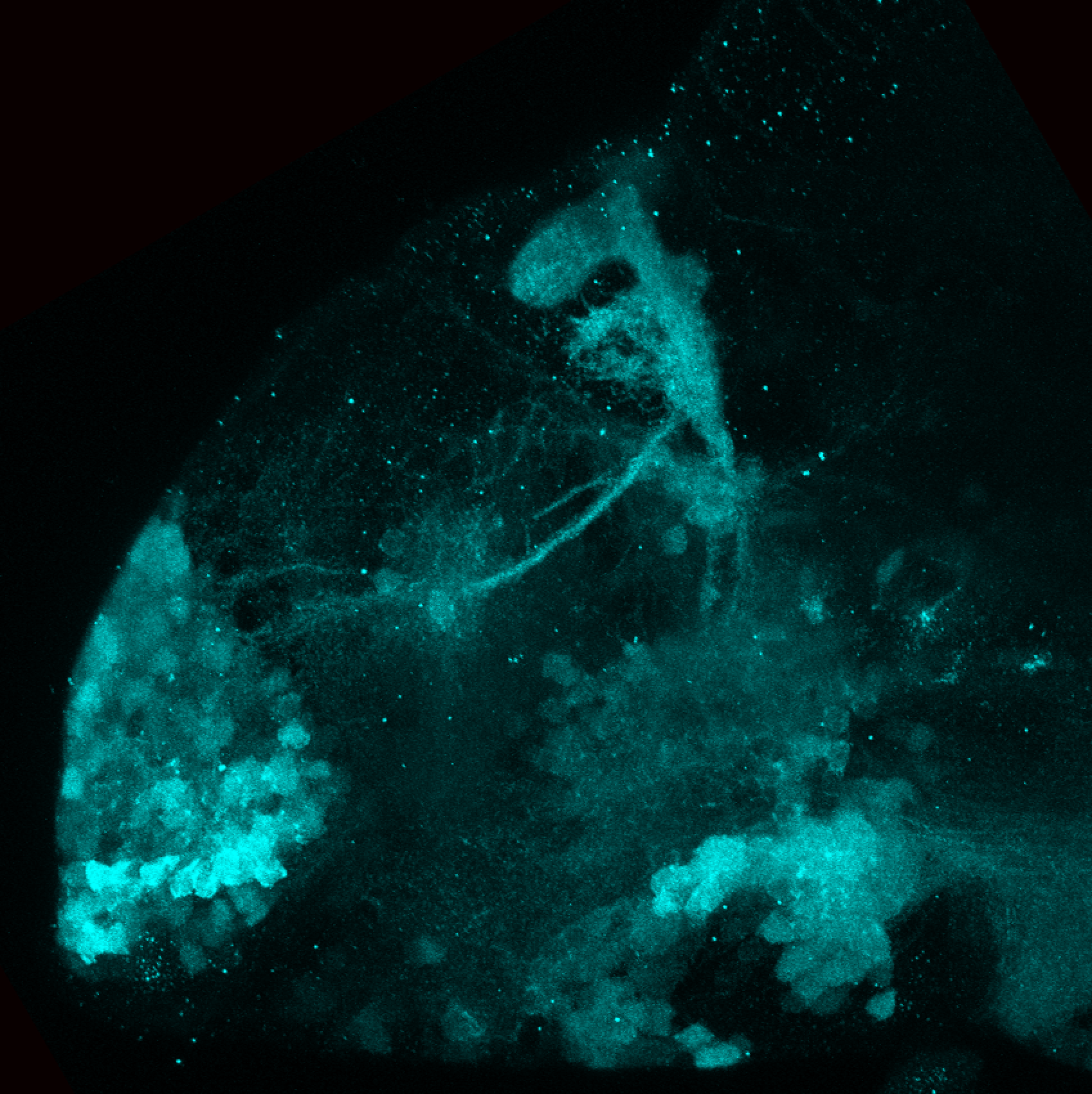 Tg(lhx5:GFP)(cyan) 4dpf lateral view
