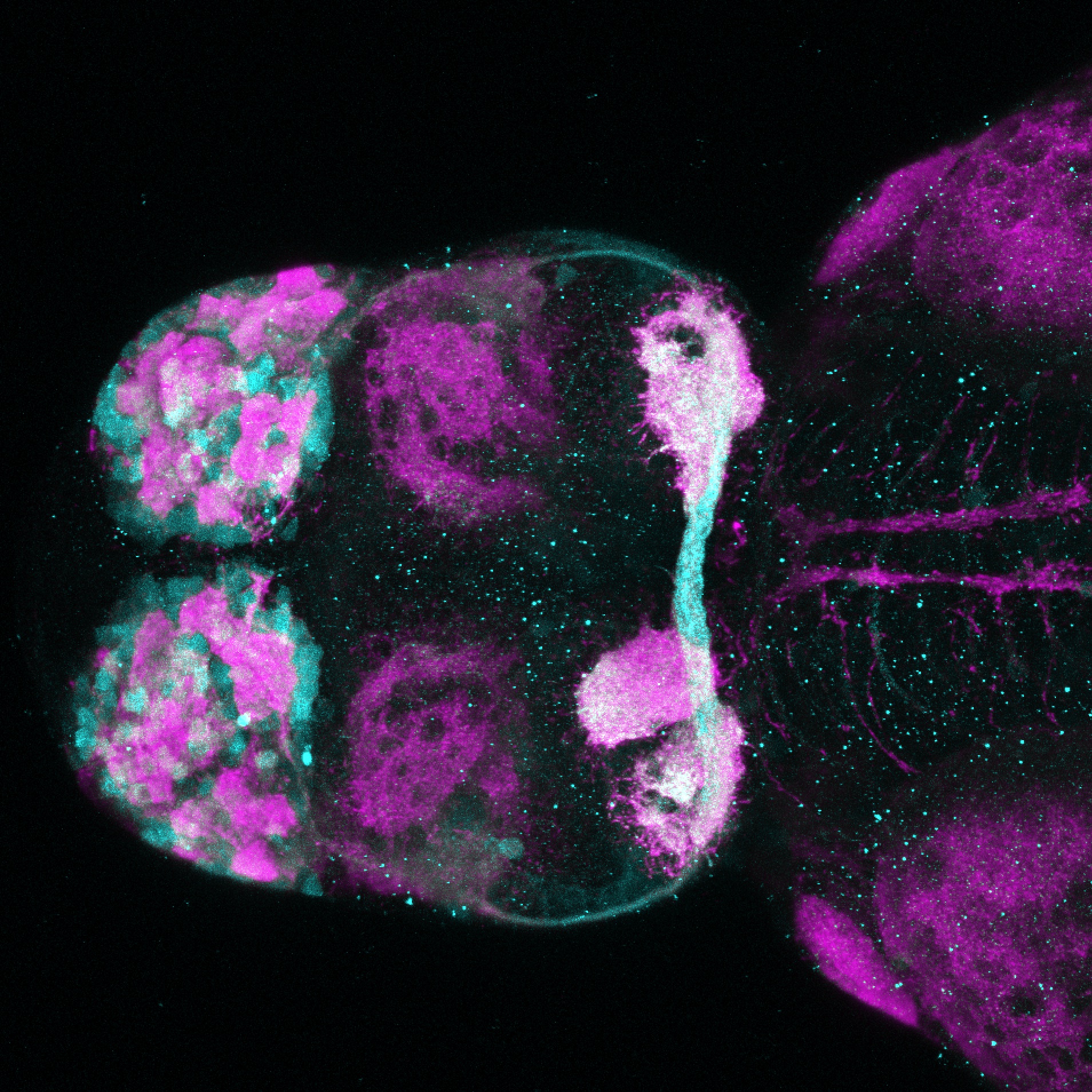 Tg(lhx5:GFP)(cyan) 4dpf dorsal view with SV2(magenta)