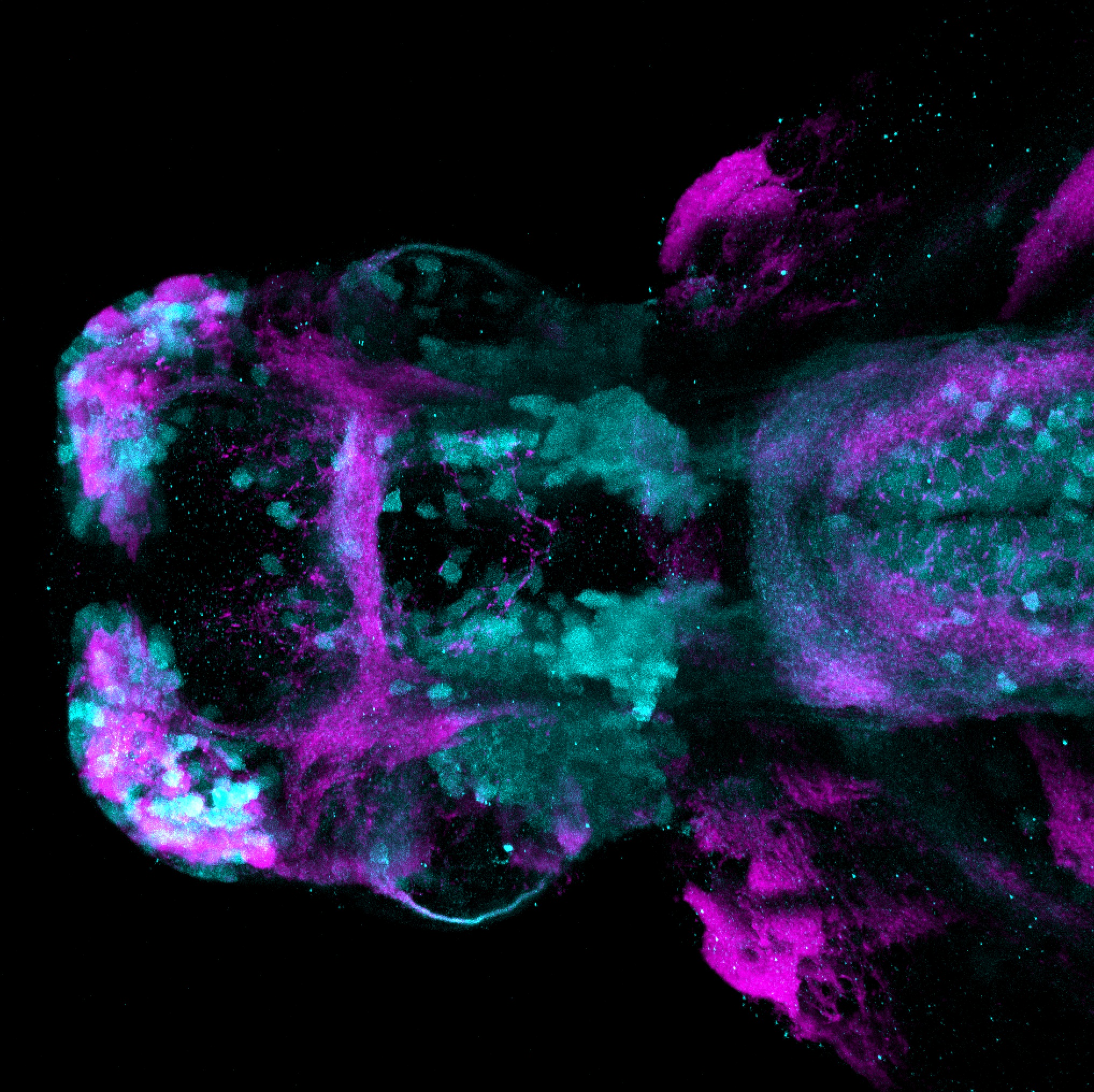 Tg(lhx5:GFP)(cyan) 4dpf ventral view with SV2(magenta)