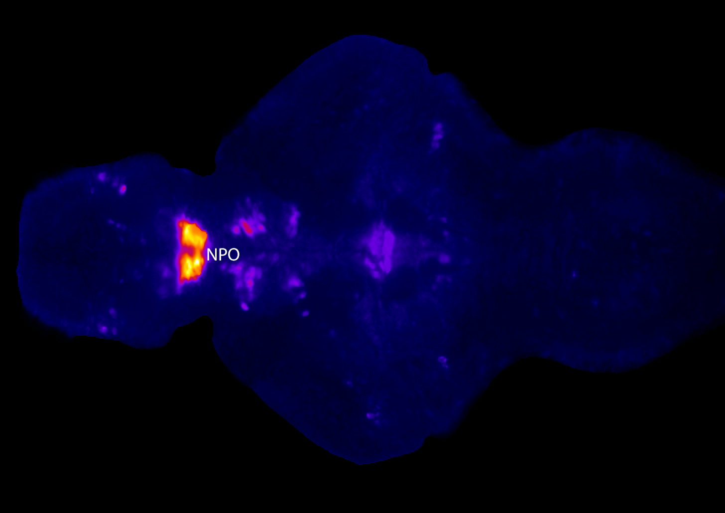  NPO: neurosecretary preoptic area 