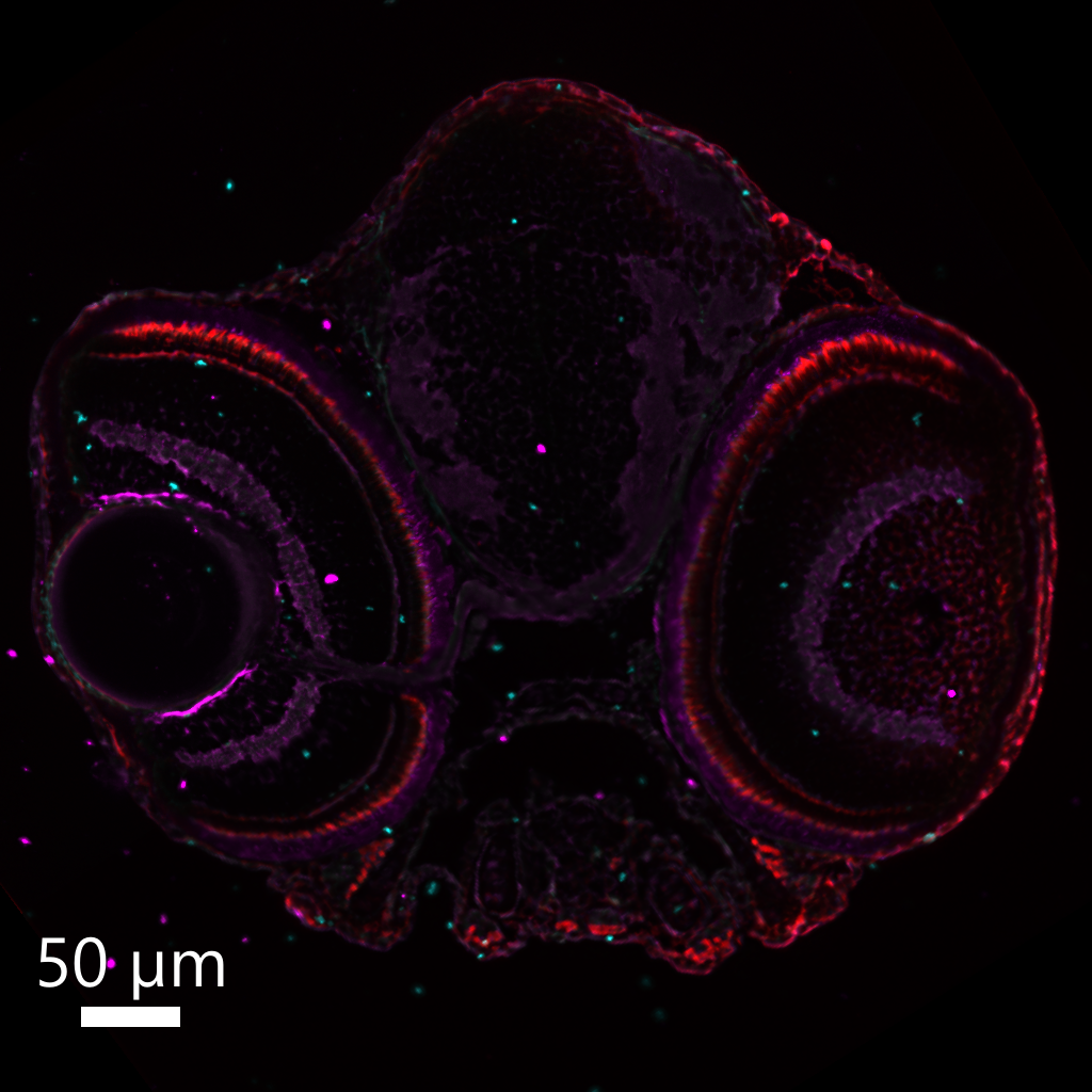 Section of 5 dpf zebrafish head anti-Gnat2 in red, anti-Rlbp1 in magenta and anti-Lcp1 in cyan