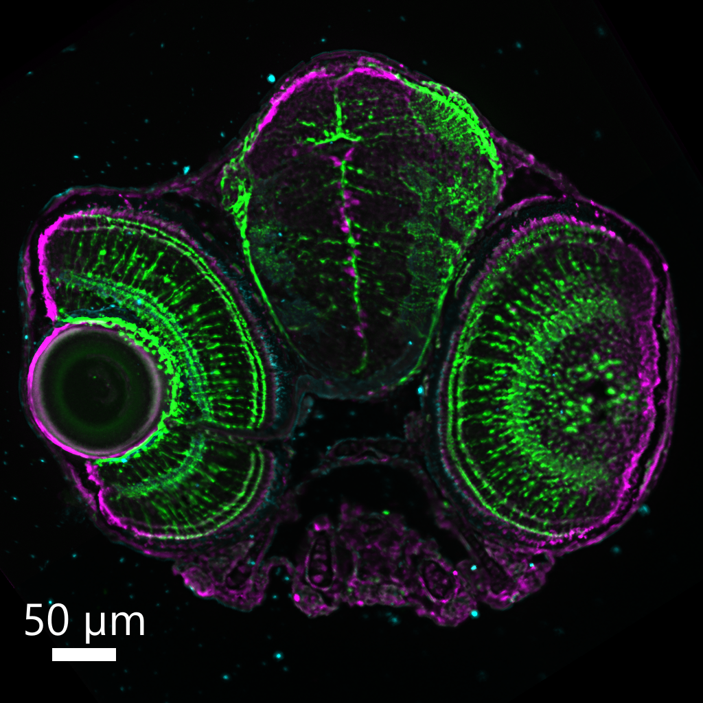 Section of 5 dpf zebrafish head anti-GS in green, anti-RPE65 in cyan and anti-PCNA in magenta