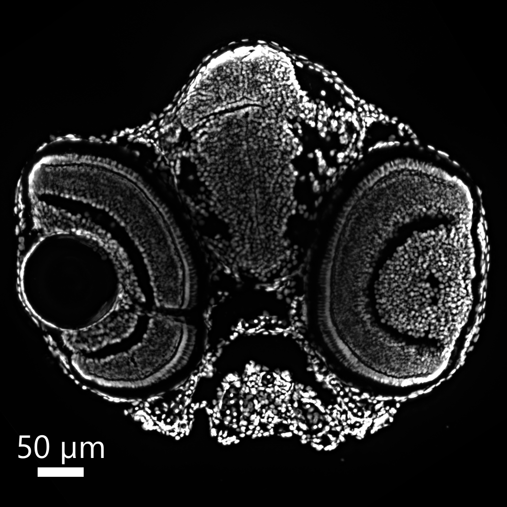 Section of 5 dpf zebrafish head DAPI in white