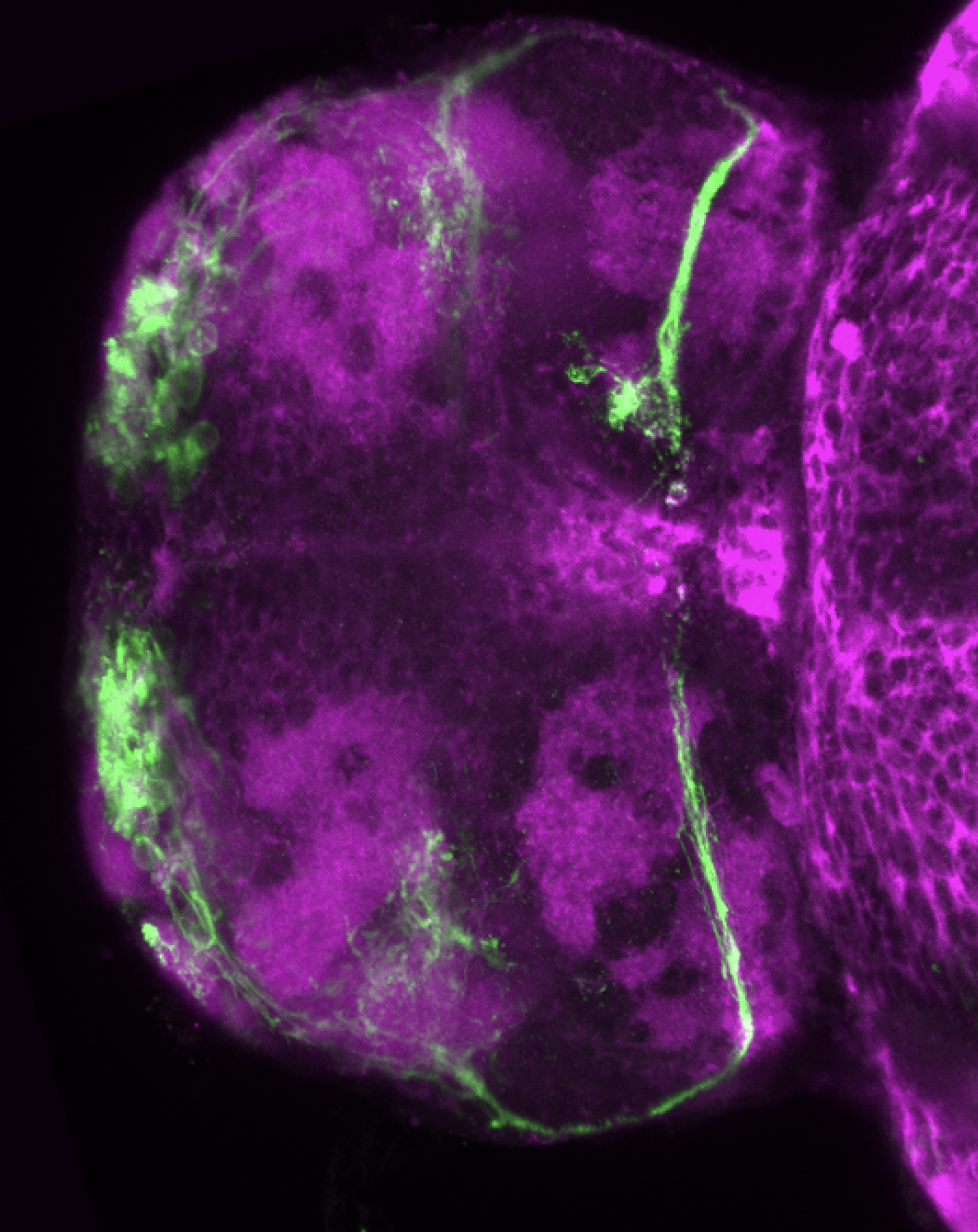 Tg(lhx2a:GAP-YFP) 4dpf dorsal