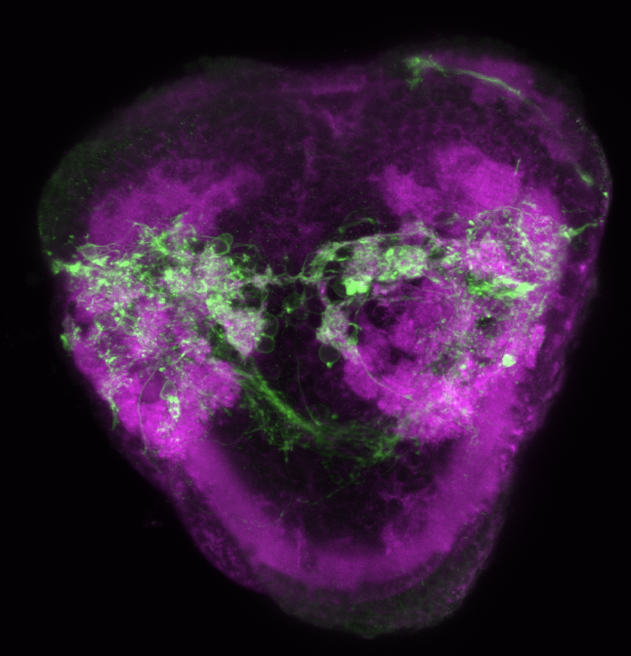 Tg(lhx2a:GAP-YFP) 4dpf frontal