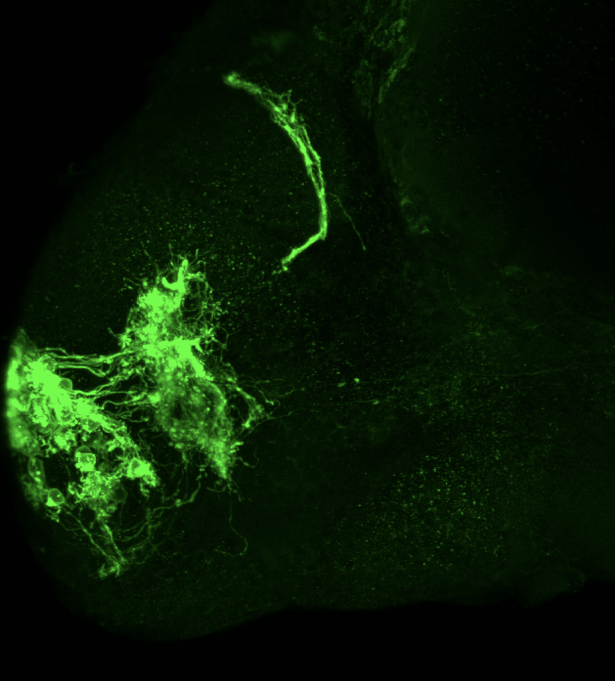 Tg(lhx2a:GAP-YFP) 4dpf lateral