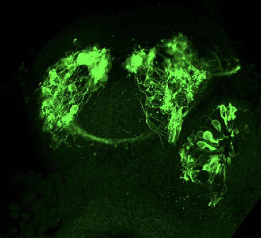 Tg(lhx2a:GAP-YFP) 3dpf frontal