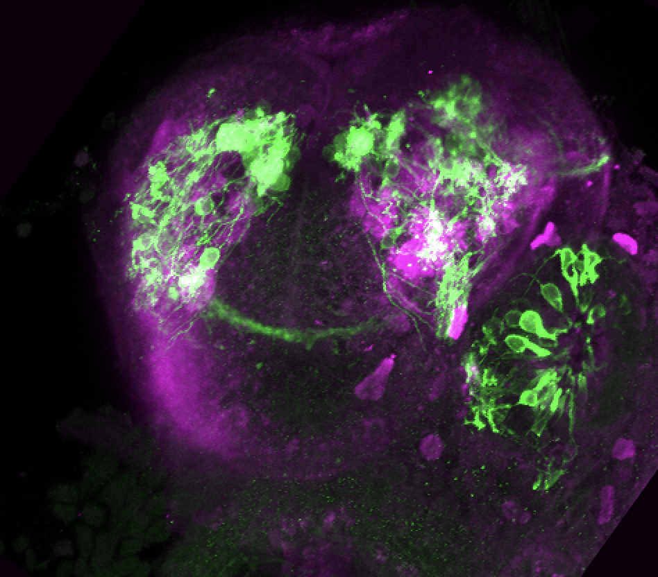 Tg(lhx2a:GAP-YFP) 3dpf frontal