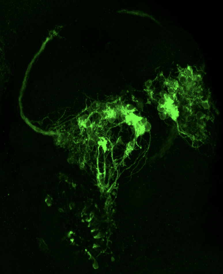 Tg(lhx2a:GAP-YFP) 3dpf frontal