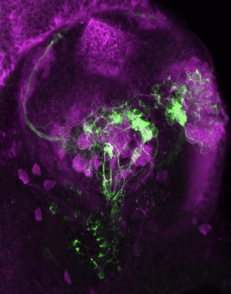 Tg(lhx2a:GAP-YFP) 3dpf frontal