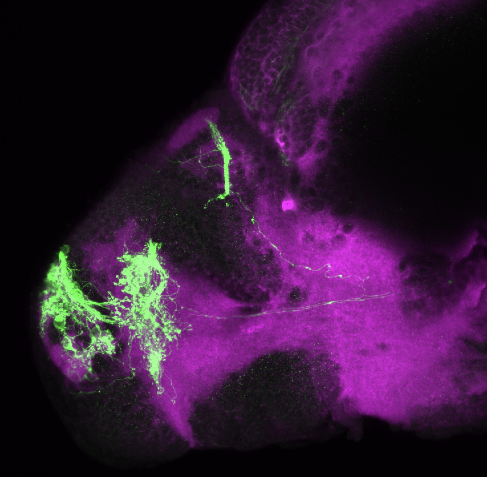 Tg(lhx2a:GAP-YFP) 3dpf lateral