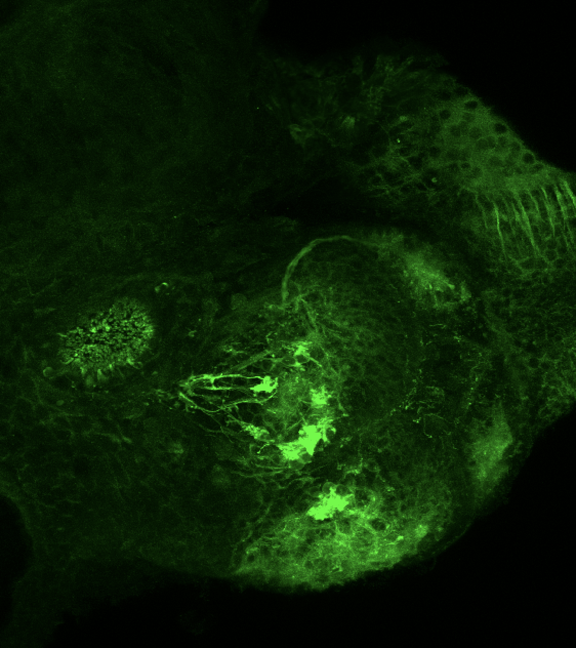 Tg(lhx2a:GAP-YFP) 3dpf frontal