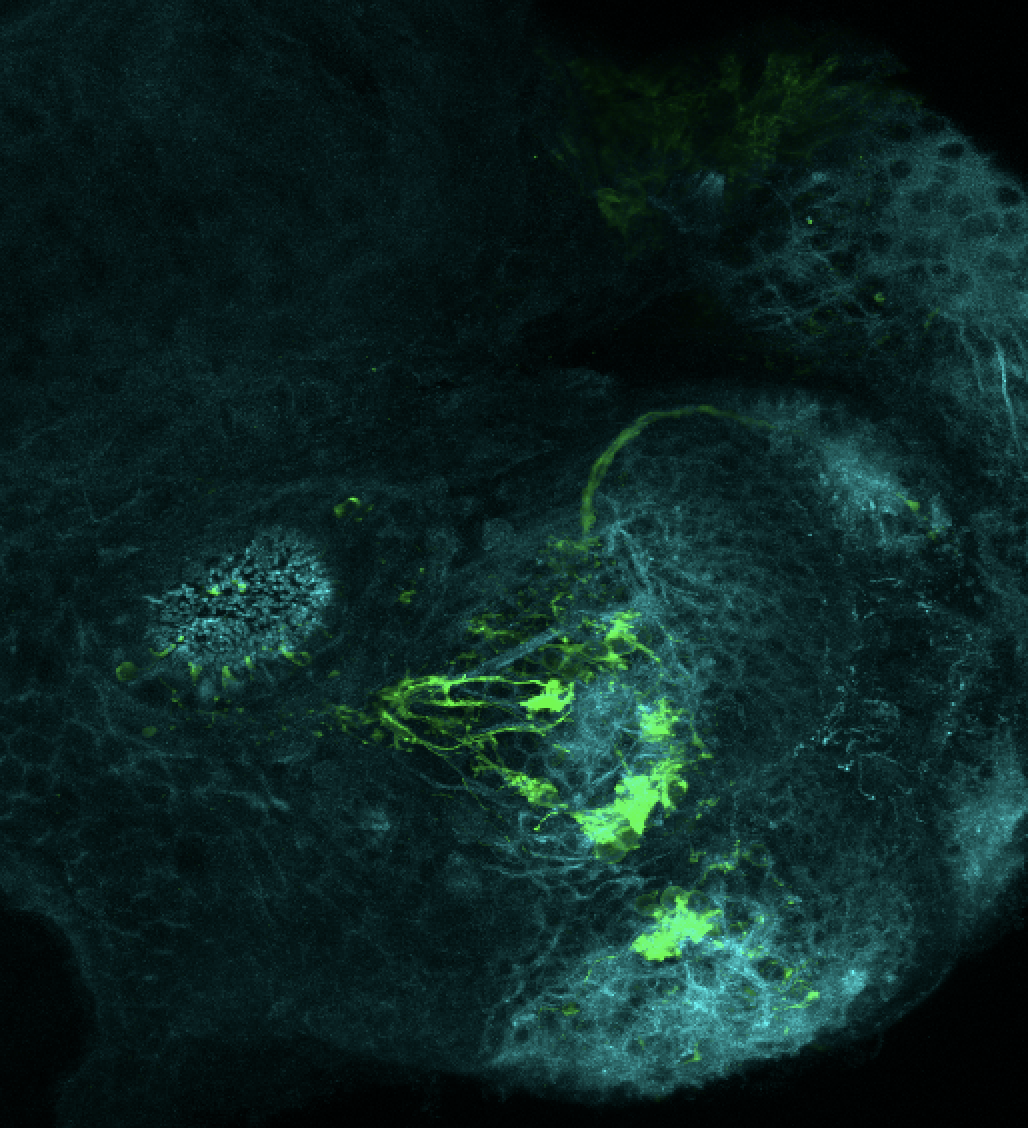 Tg(lhx2a:GAP-YFP) 3dpf frontal