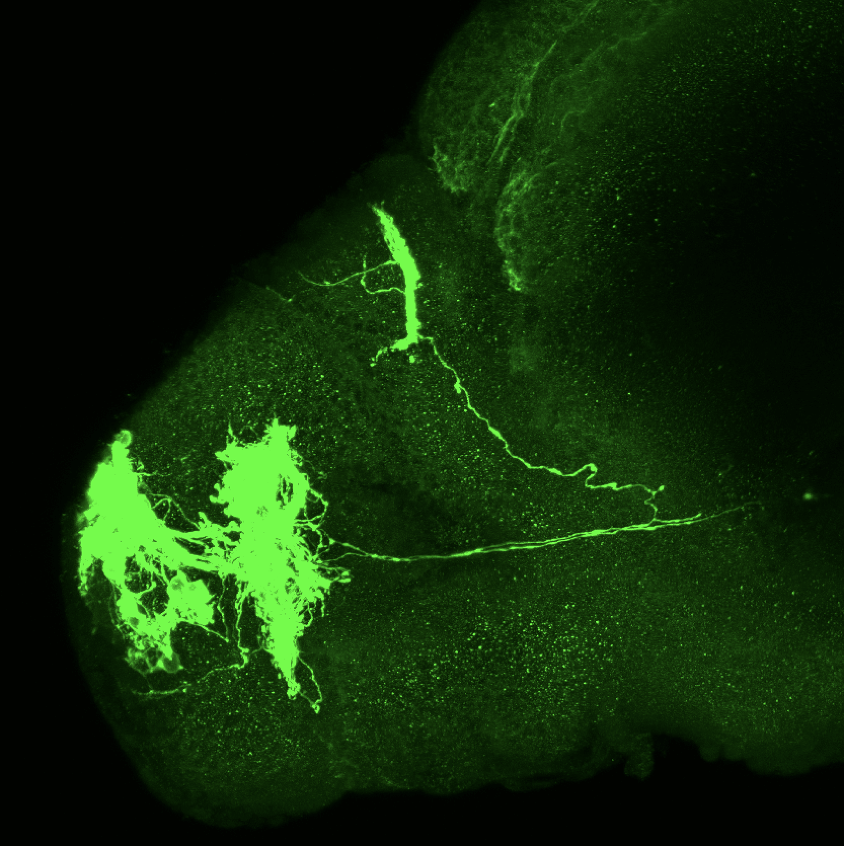 Tg(lhx2a:GAP-YFP) 3dpf lateral