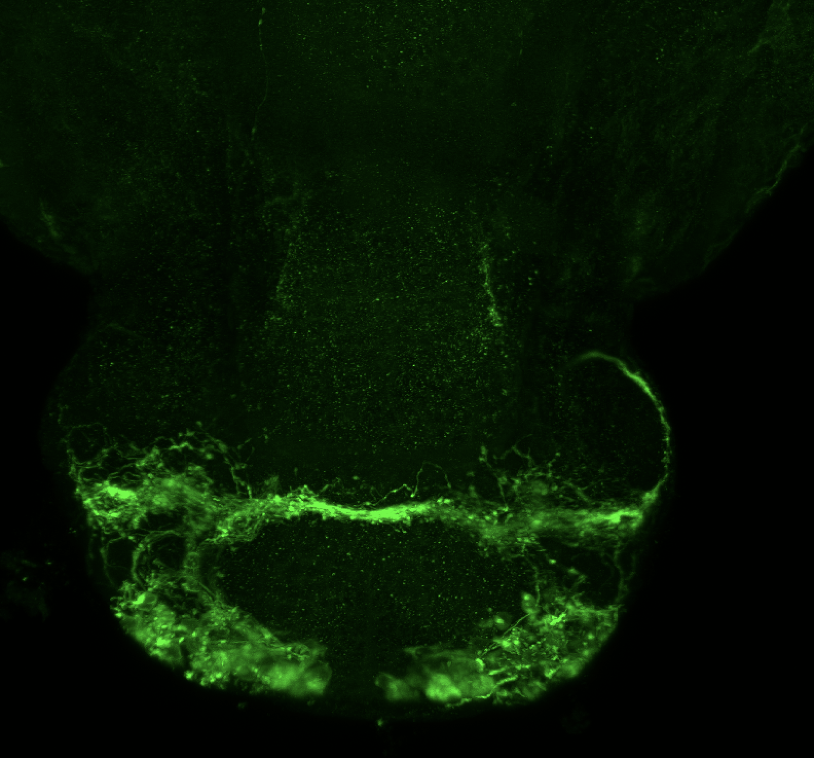 Tg(lhx2a:GAP-YFP) 4dpf ventral