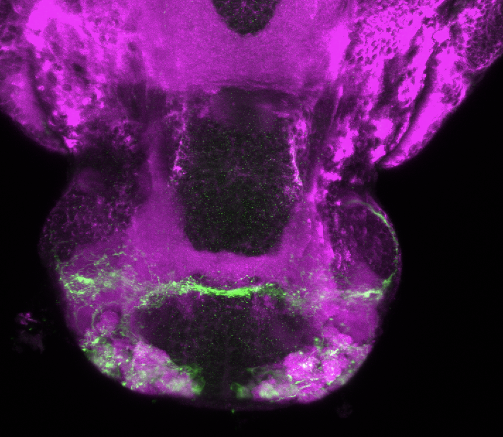 Tg(lhx2a:GAP-YFP) 4dpf ventral