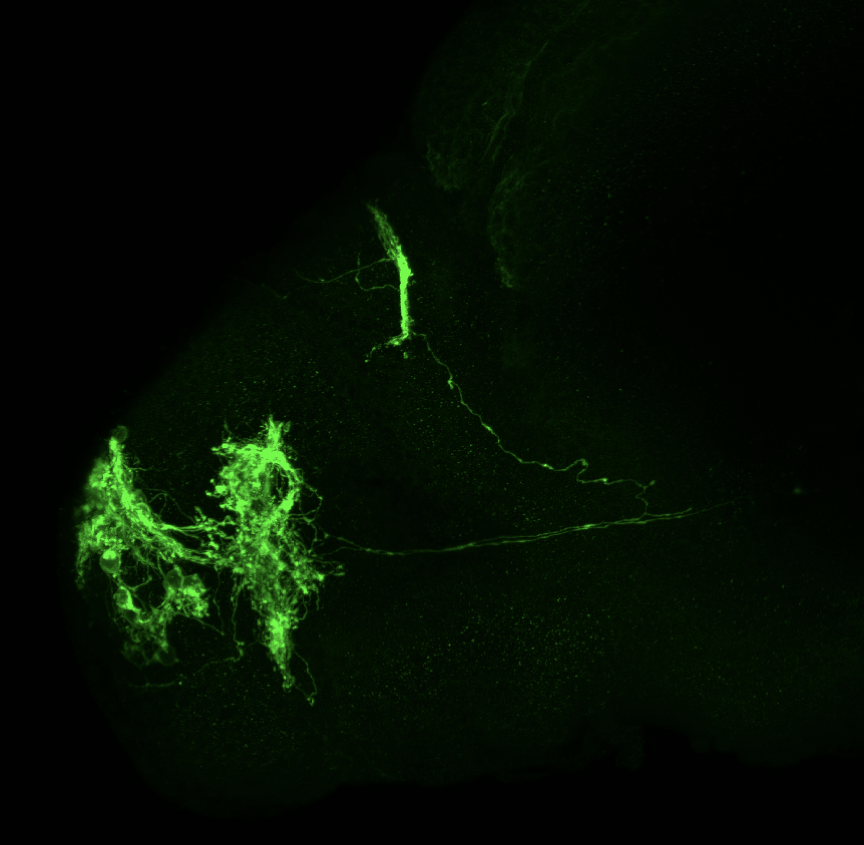 Tg(lhx2a:GAP-YFP) 3dpf lateral