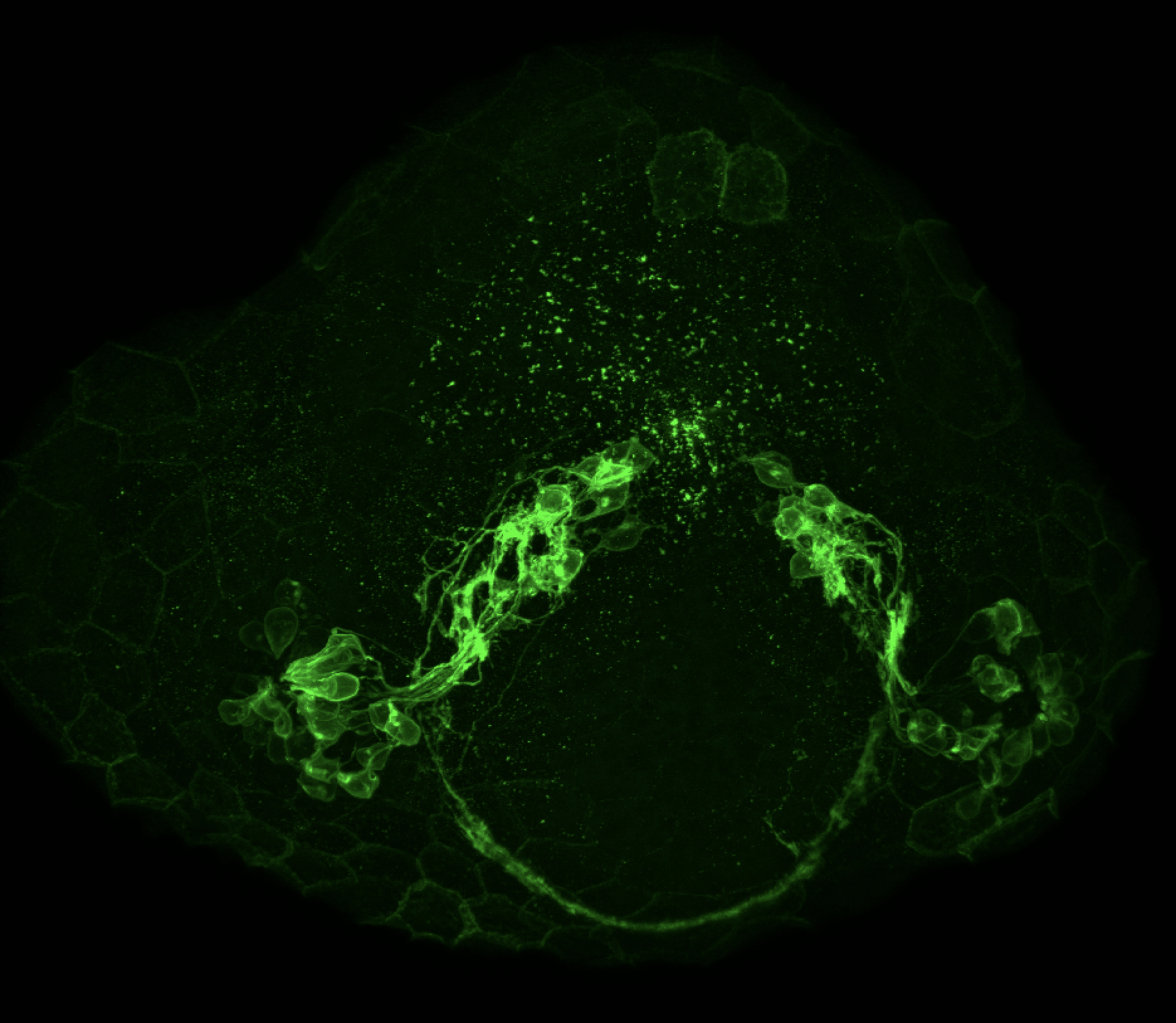 Tg(lhx2a:GAP-YFP) 24hpf frontal