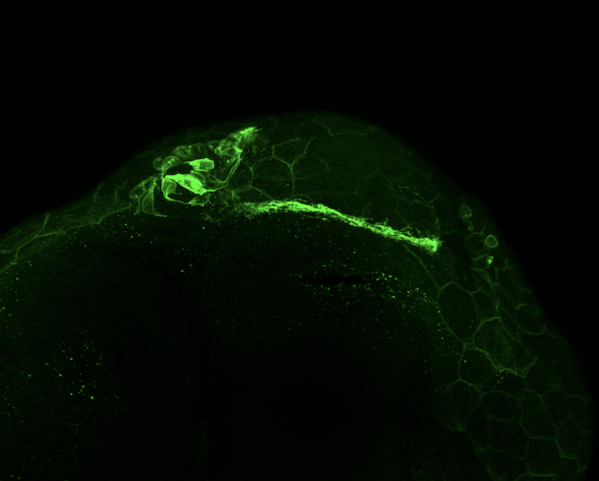 Tg(lhx2a:GAP-YFP) 24hpf ventral