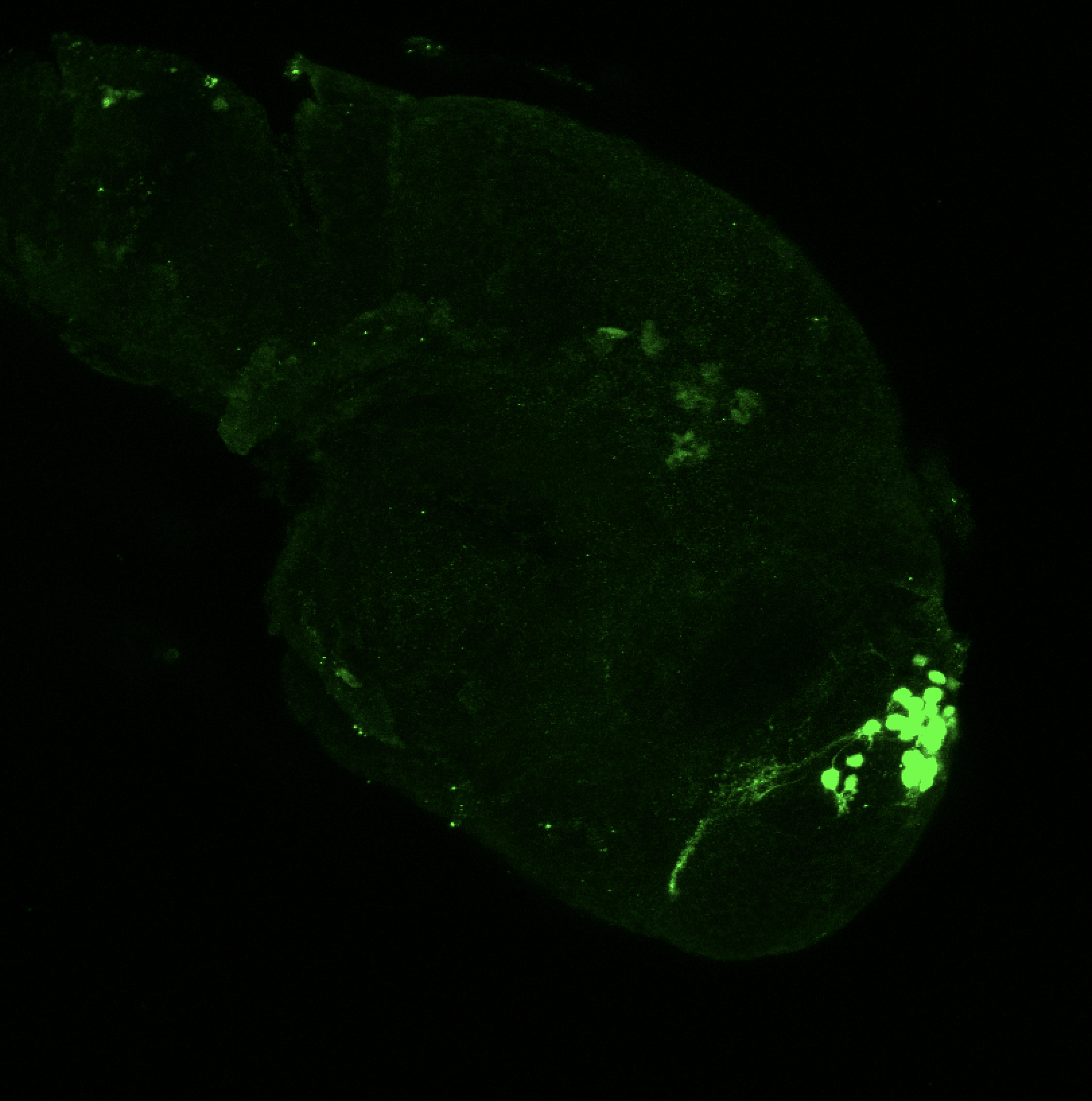 Tg(lhx2a:GFP) 48hpf lateral