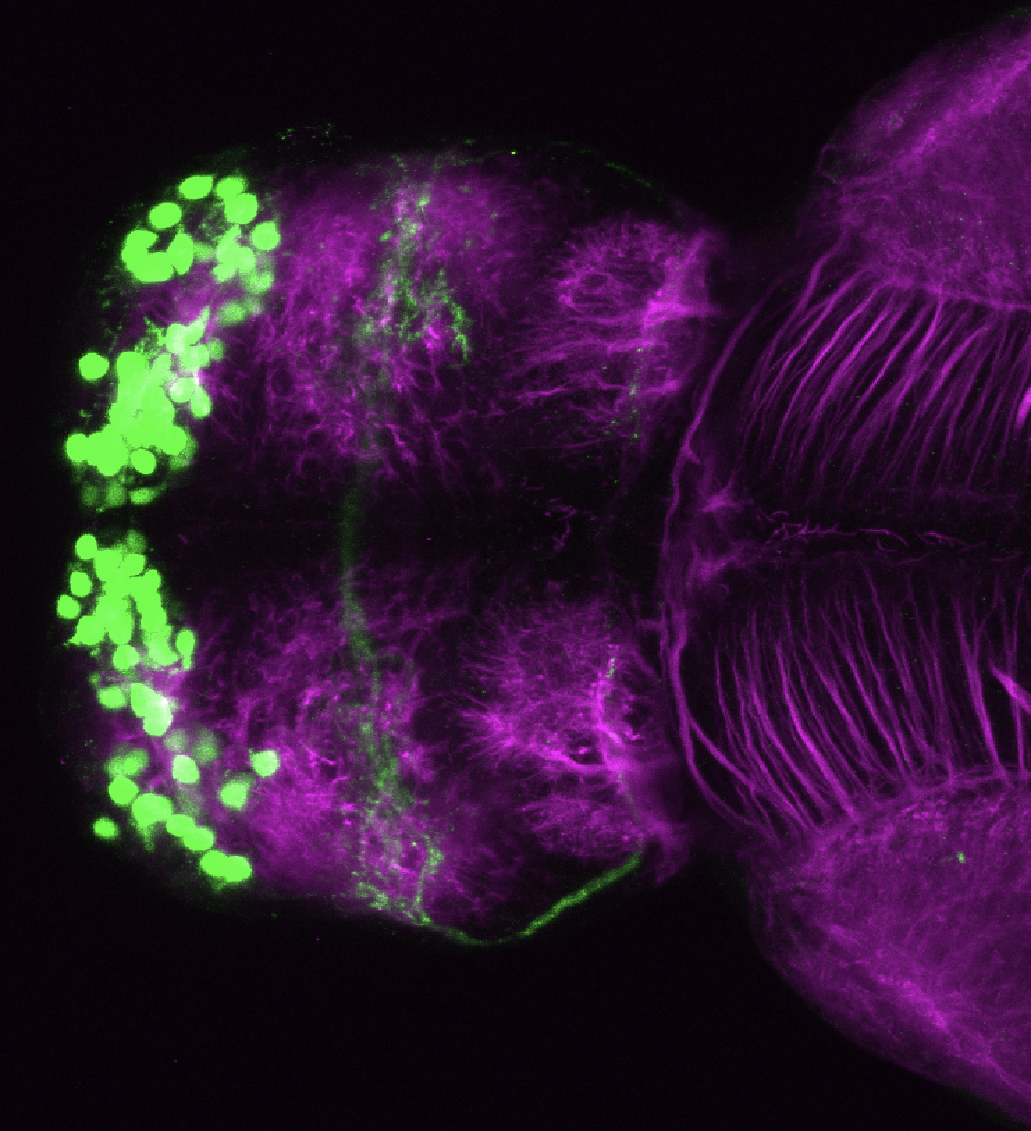 Tg(lhx2a:GFP) 4dpf dorsal 