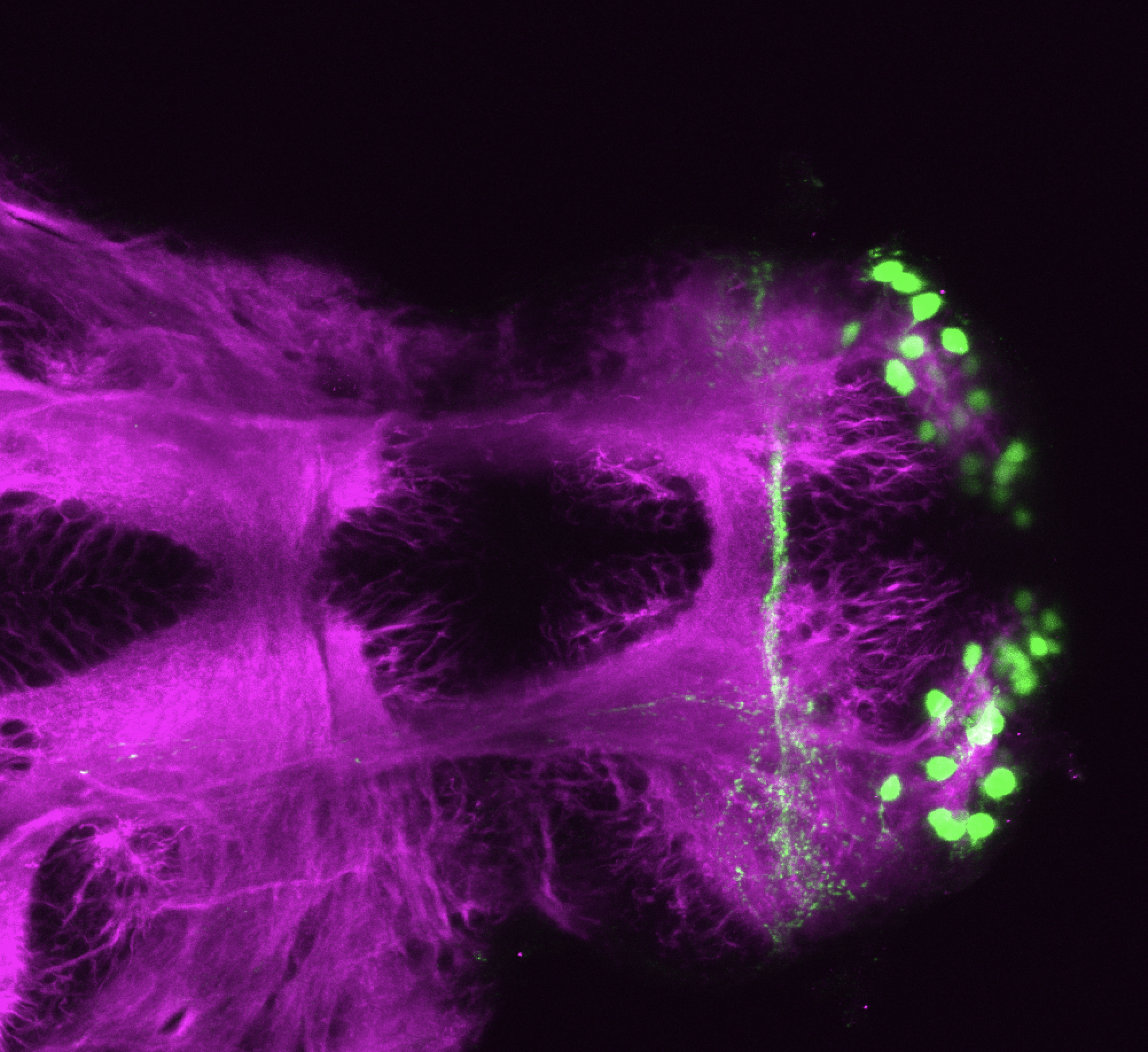 Tg(lhx2a:GFP) 4dpf vent 