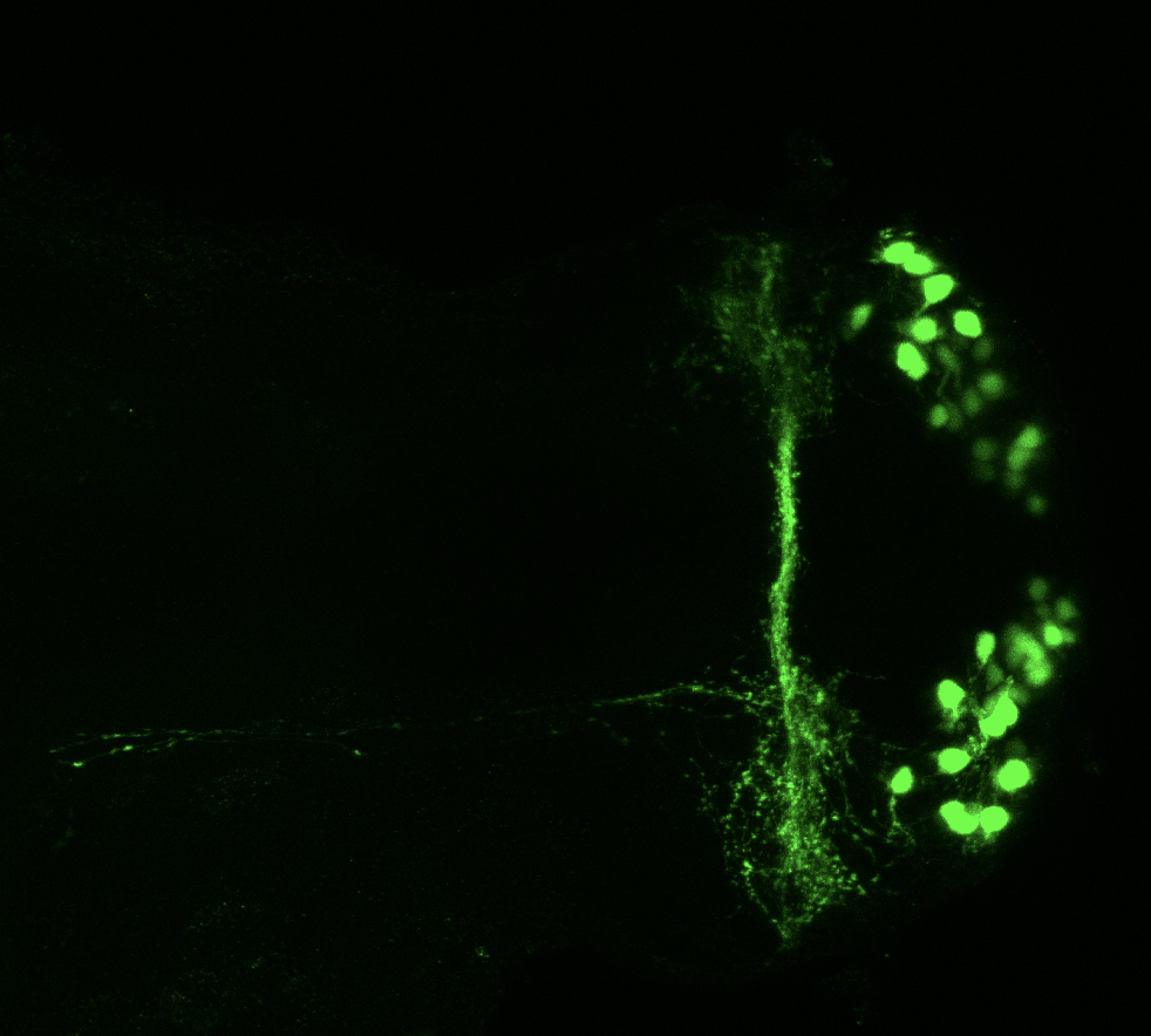 Tg(lhx2a:GFP) 4dpf vent 