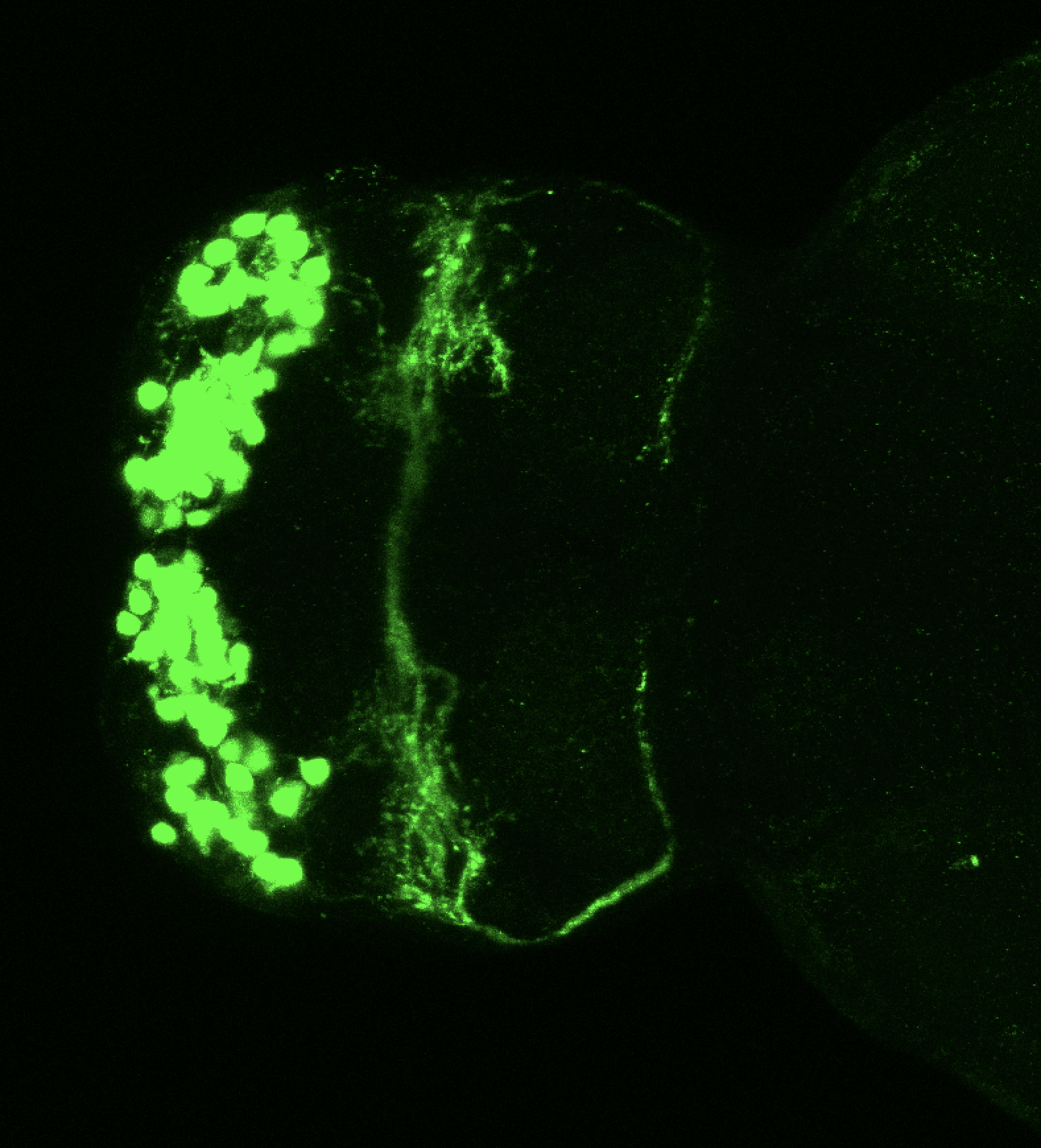 Tg(lhx2a:GFP) 4dpf dorsal 