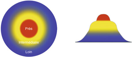 Presbytie et myopie : peut on tout traiter au laser?