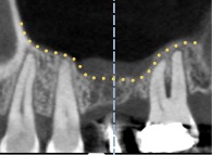 Sinus_pre.jpg