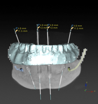 cbct scan.png