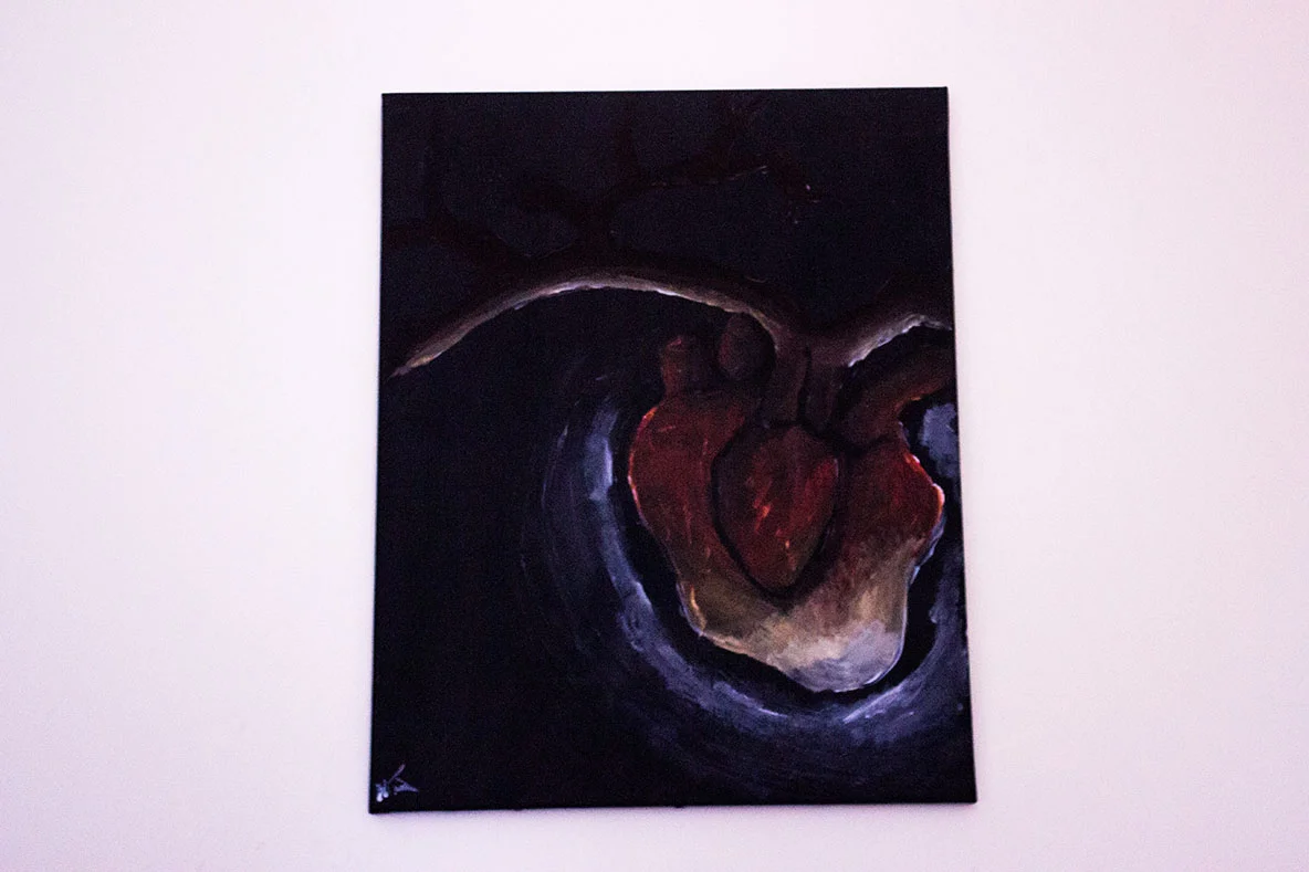 Strange Fruit