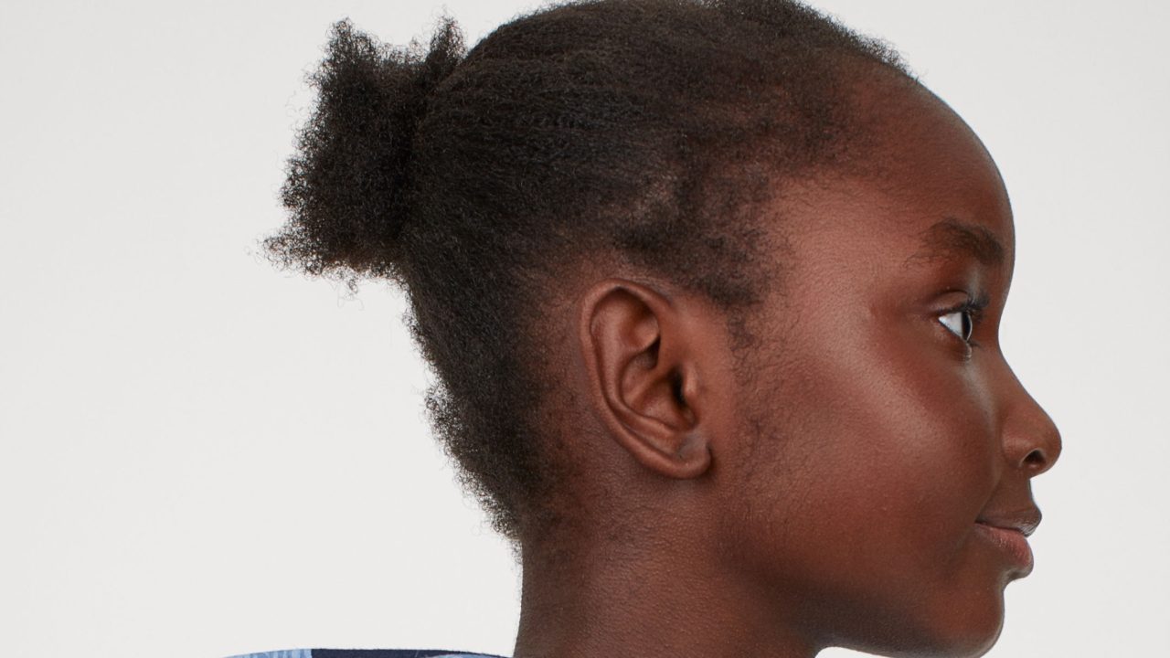 Black Hair Hurts: A Triggered Trauma Response to H&M