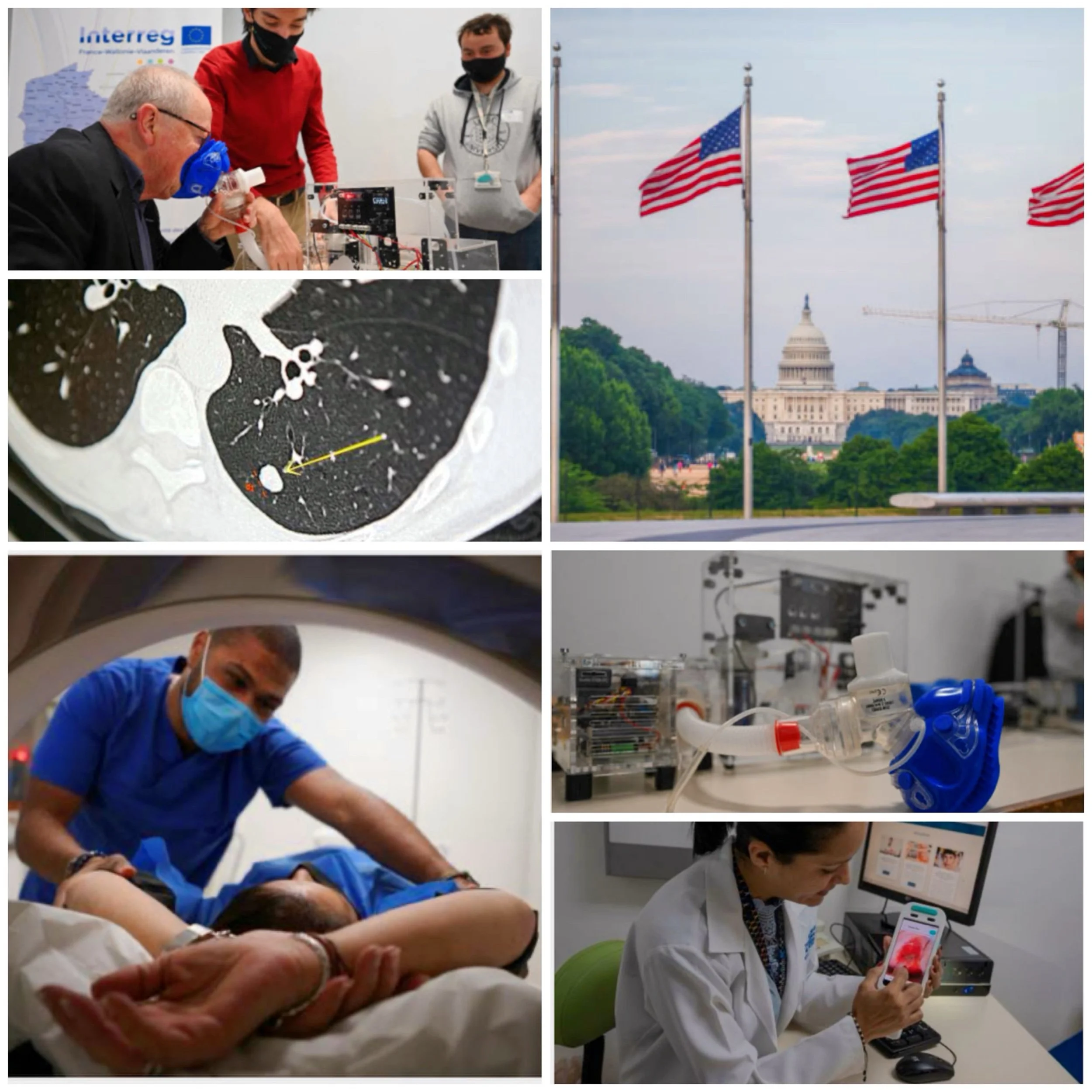 AI use to detect cancer and treat is most advance in which nation? 