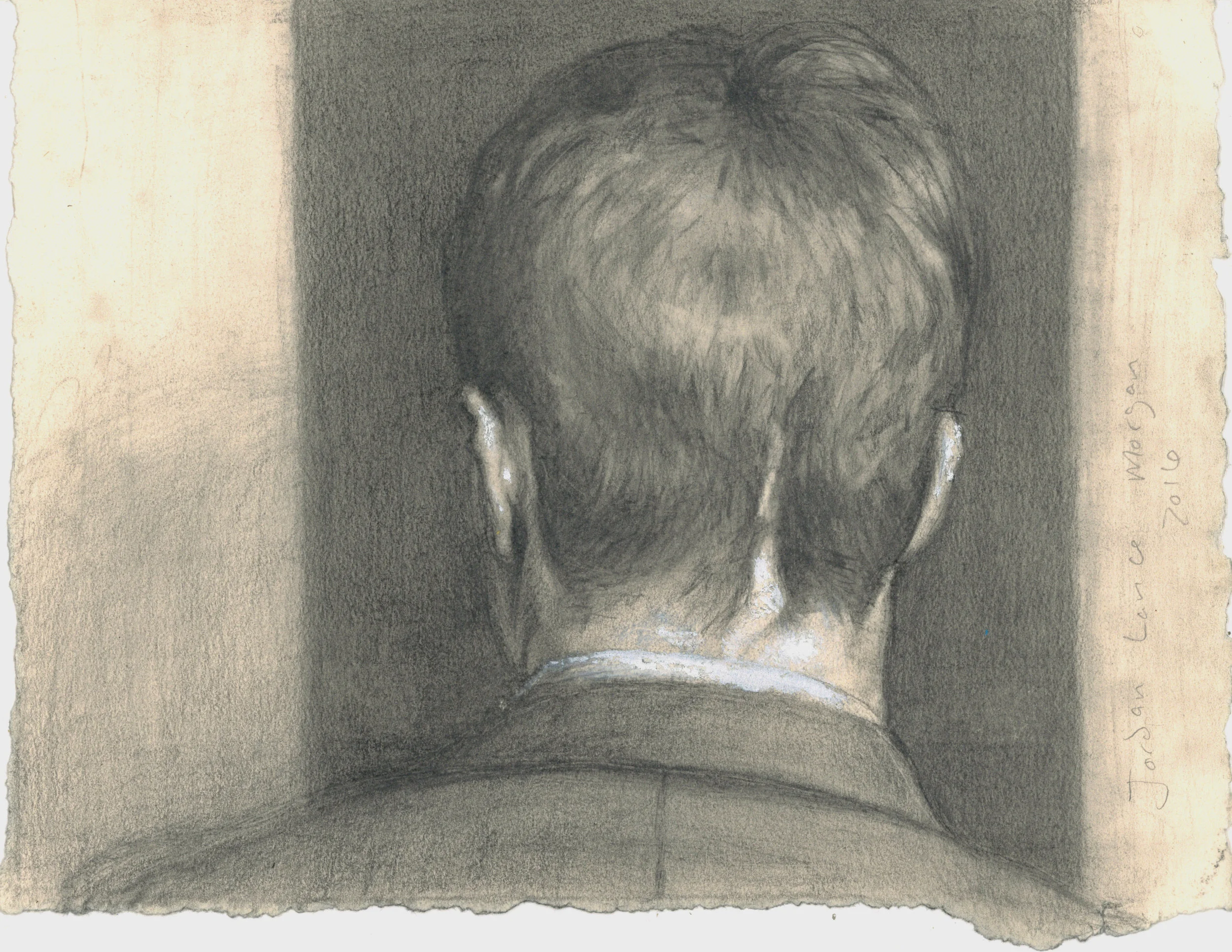 Study of Black Bile