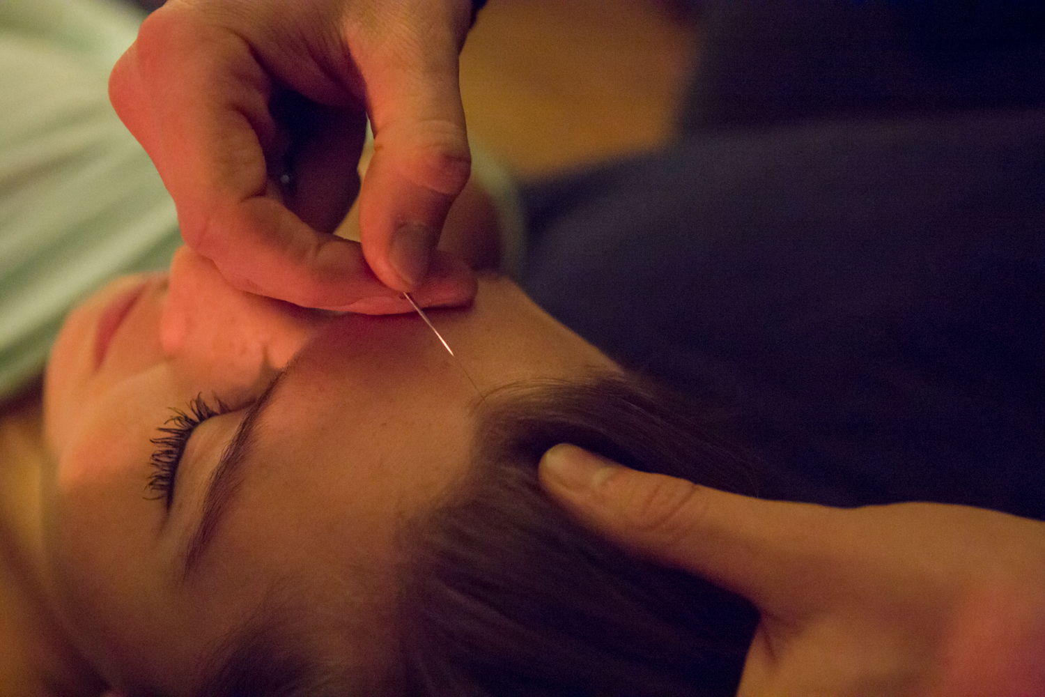 20161218_MeridianAcupuncture_24_WebSized.jpg