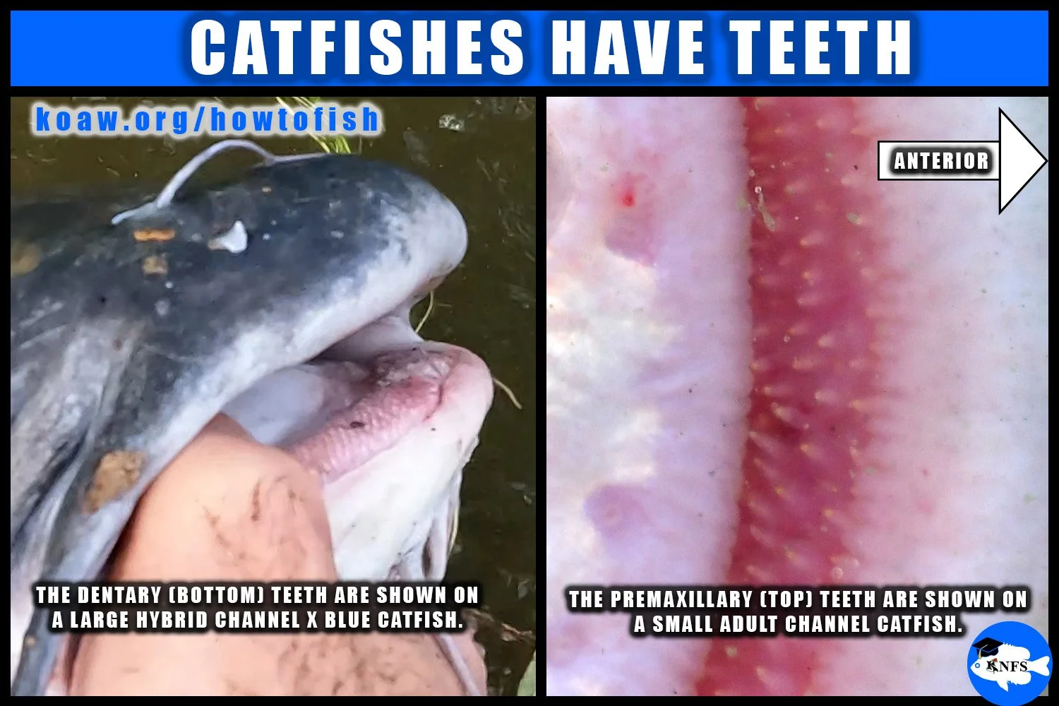 Catfishes do have teeth of varying structures capable of cutting a human hand.