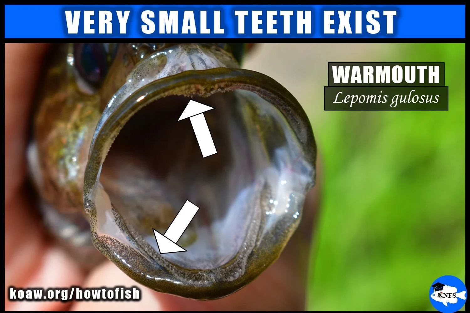 Image shows the teeth of a Warmouth (Lepomis gulosus).
