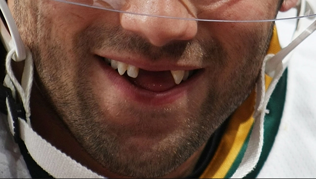 Play Sports but Keep your Teeth!