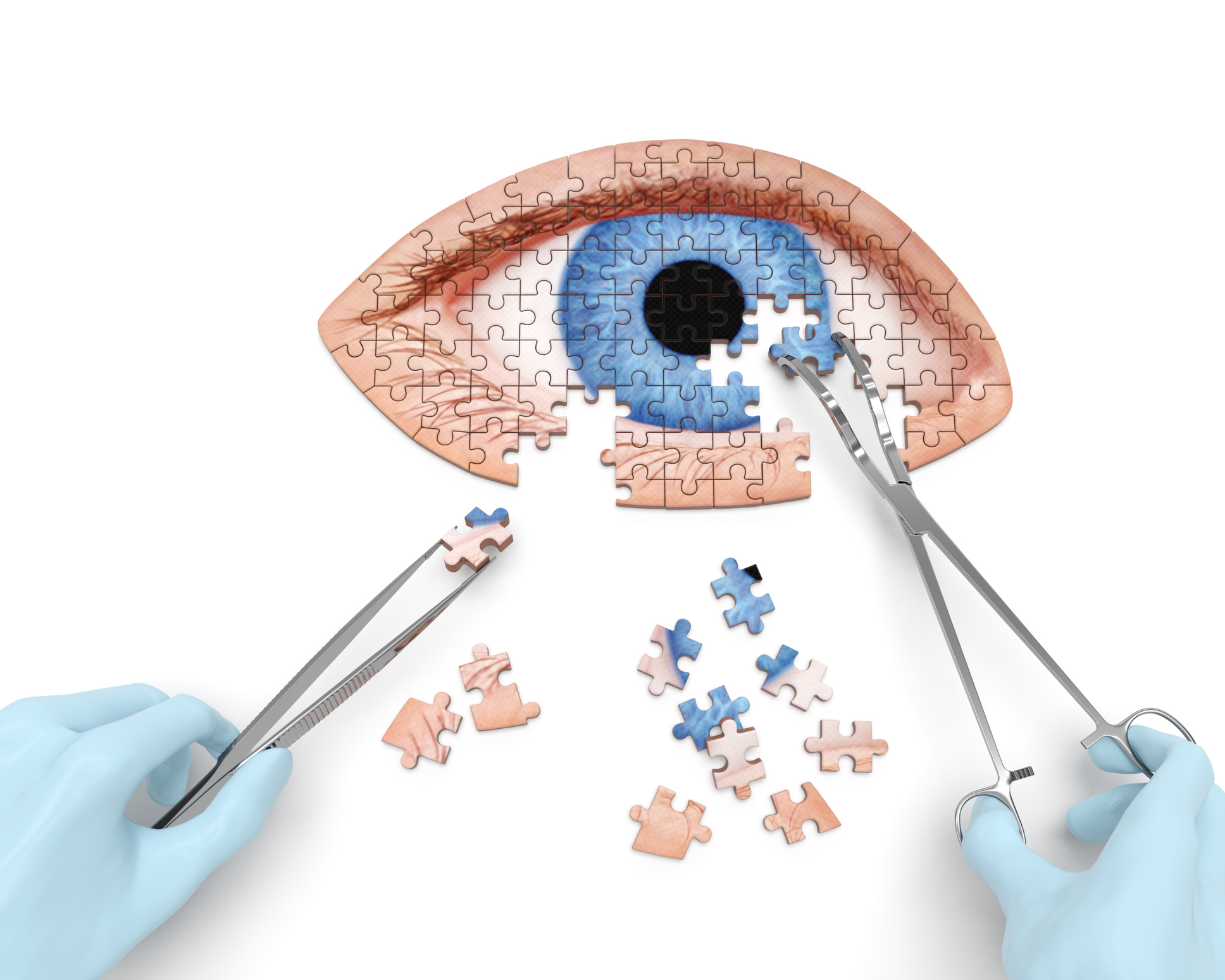 Foreign body removal from eye