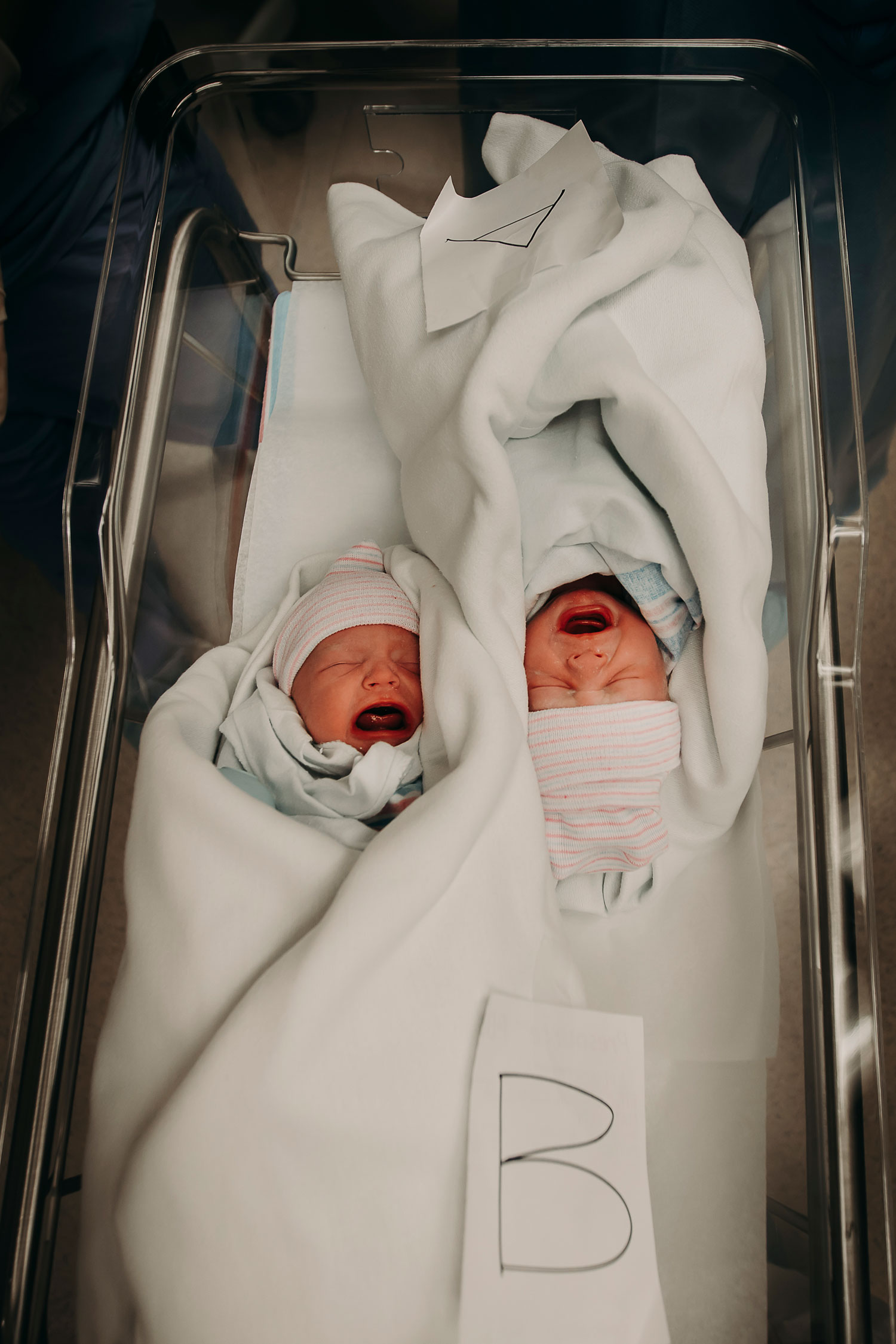 Hawaii-Birth-Photographer-Twins-Cesarean-21.jpg