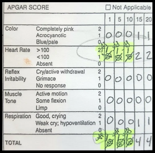 Kali APGAR spoliation.jpg