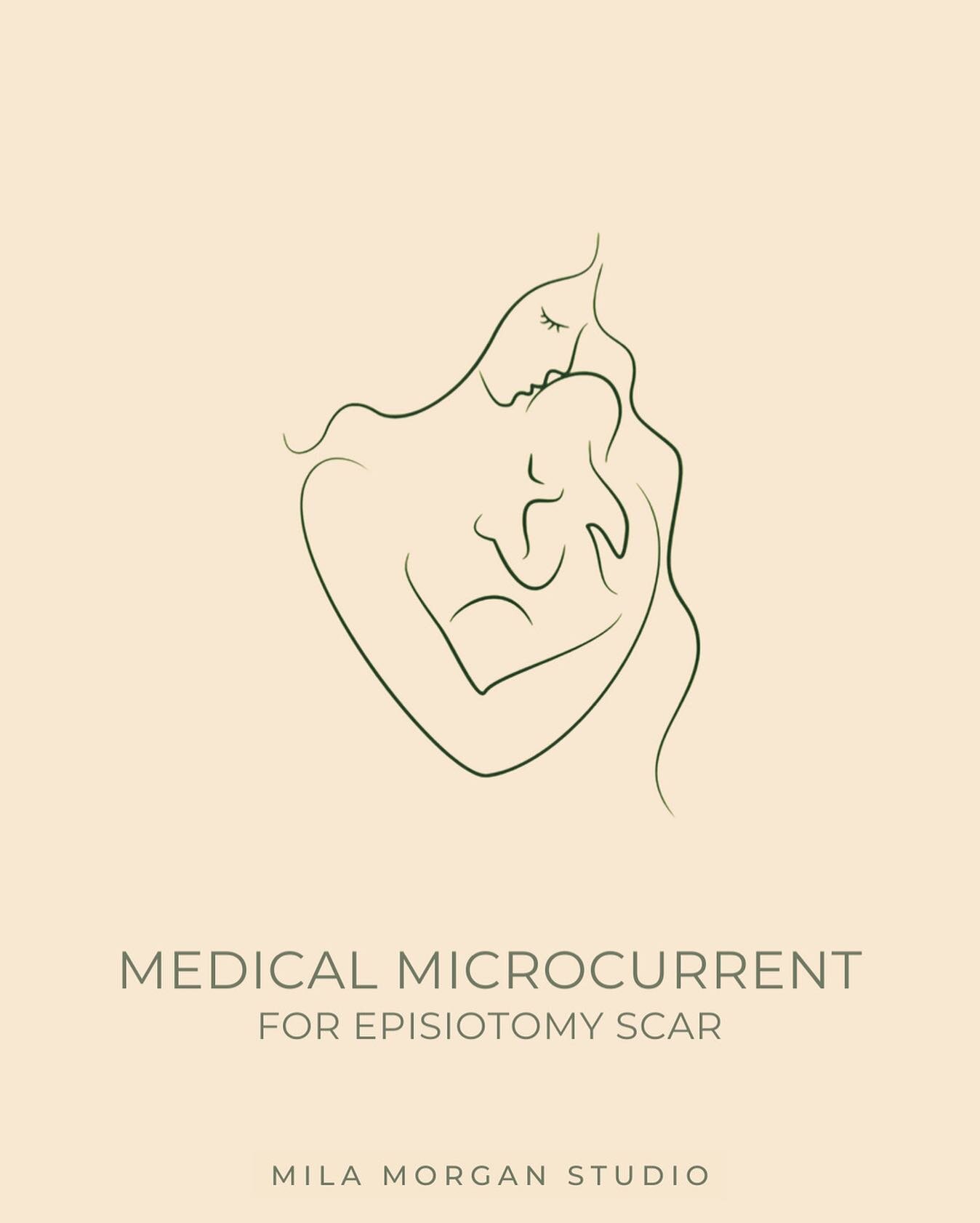 I used MMC for an episiotomy scar from a 4th-degree laceration during the end of the client's labor. These can be surgical cuts to help get the baby out or ripping/tearing due to pushing.
⠀⠀⠀⠀⠀⠀⠀⠀⠀
Episiotomy lacerations can be less severe but a 4th 