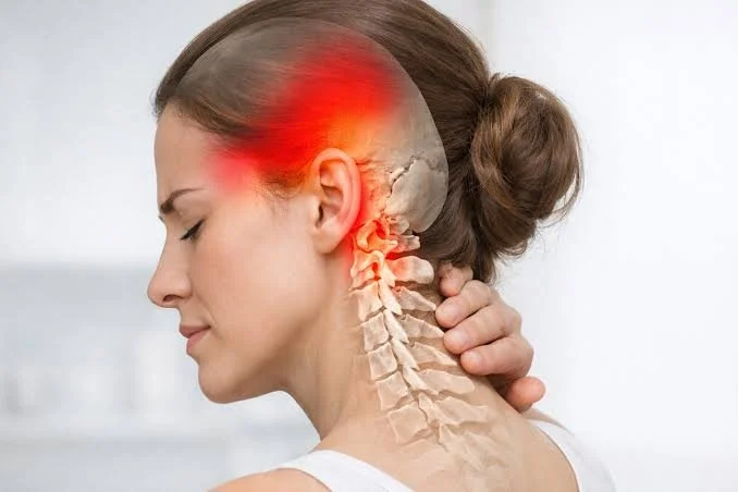 CERVICOGENIC HEADACHES