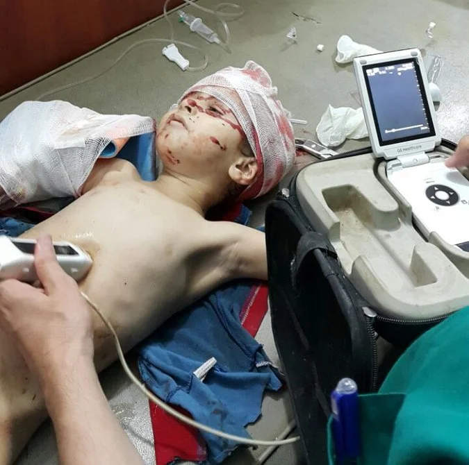 Ahmad, age 2, who died from his injuries shortly after this photo was taken