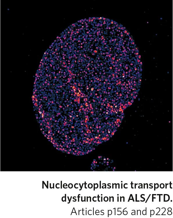 Nature Neuroscience, volume 21, issue 2, table of contents