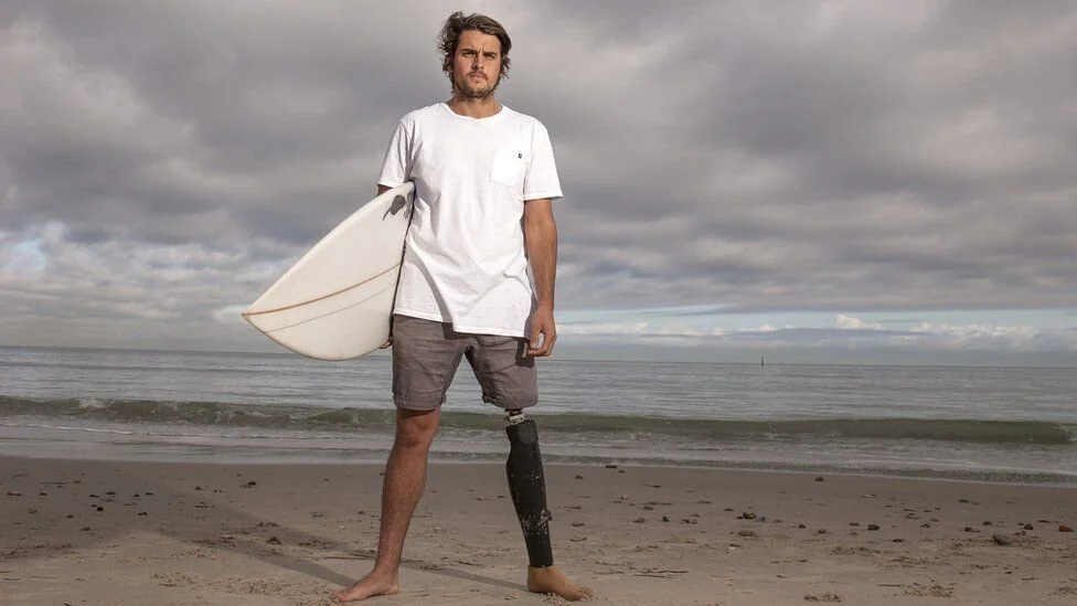 Shark Attack Survivor Loses Leg But Wins Right To Keep Shark's Tooth